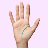 Handl