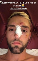 Irre: Vogel kracht durch Helm von Motorrad-Profi