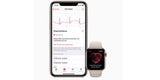 Apple Watch jetzt auch bei uns mit EKG-Funktion