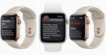 Apple Watch jetzt auch bei uns mit EKG-Funktion