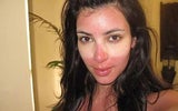 Kim Kardashians Sonnenbrand-Panne