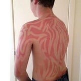 Sonnenbrand-Tattoo