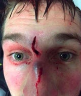Eishockey-Star postet Horror-Selfie