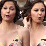 Botox? Von wegen...