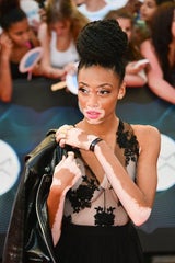 Winnie Harlow