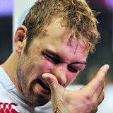 So schmerzhaft kann Rugby sein