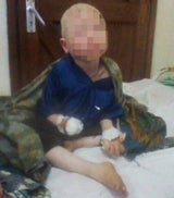 Albino-Junge: Hand für Liebestrank