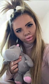 BigLipKayla - Über ihren Look spottet das Web