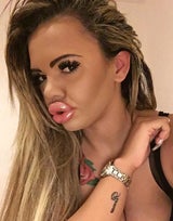 BigLipKayla - Über ihren Look spottet das Web