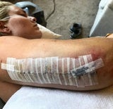 Vonn