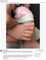 Babyfuß