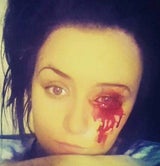 Dieses Mädchen weint Blut