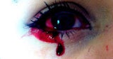 Dieses Mädchen weint Blut