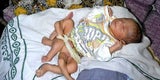Baby 6 Beine