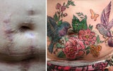 Tattookünstlerin verdeckt Narben von Gewaltopfern