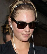 Kate Upton ungeschminkt: Hautprobleme