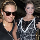 Kate Upton ungeschminkt: Hautprobleme