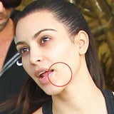 Kim Kardashian: Bad Skin-Day