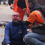 Brüssel: Verletzte bei Gewerkschaftsdemo