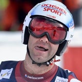 Die besten Bilder zum Super G