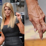 Kirstie Alley: Glattes Gesicht, faltige Hände
