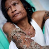dede_03_getty
