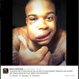 Baseball-Star DeShields twittert Schock-Foto