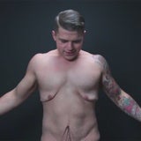 Haut nach 70 Kilo Gewichtsverlust