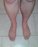 Hairy Legs Club