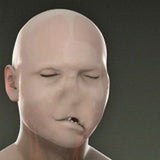 transplantation2_ap