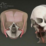 transplantation3_ap
