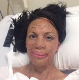 Turia Pitt