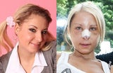 Katzi Anastasia Sokol neue Nase