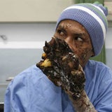 baum_05_reuters