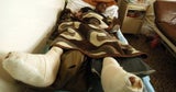 Ein Verletzter in einem Krankenhaus von Bengasi