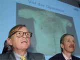 transplantation