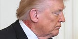 Ausschlag an Trumps Hals