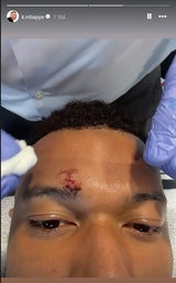 Blut-Schock um Mbappé – Real bangt vor Bayern-Kracher