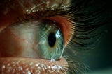 Start-up aus Österreich entwickelt Demenz-Augenscan