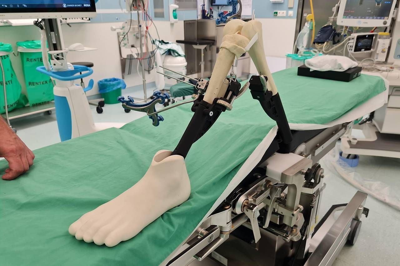 Künstliches Knie für OP.