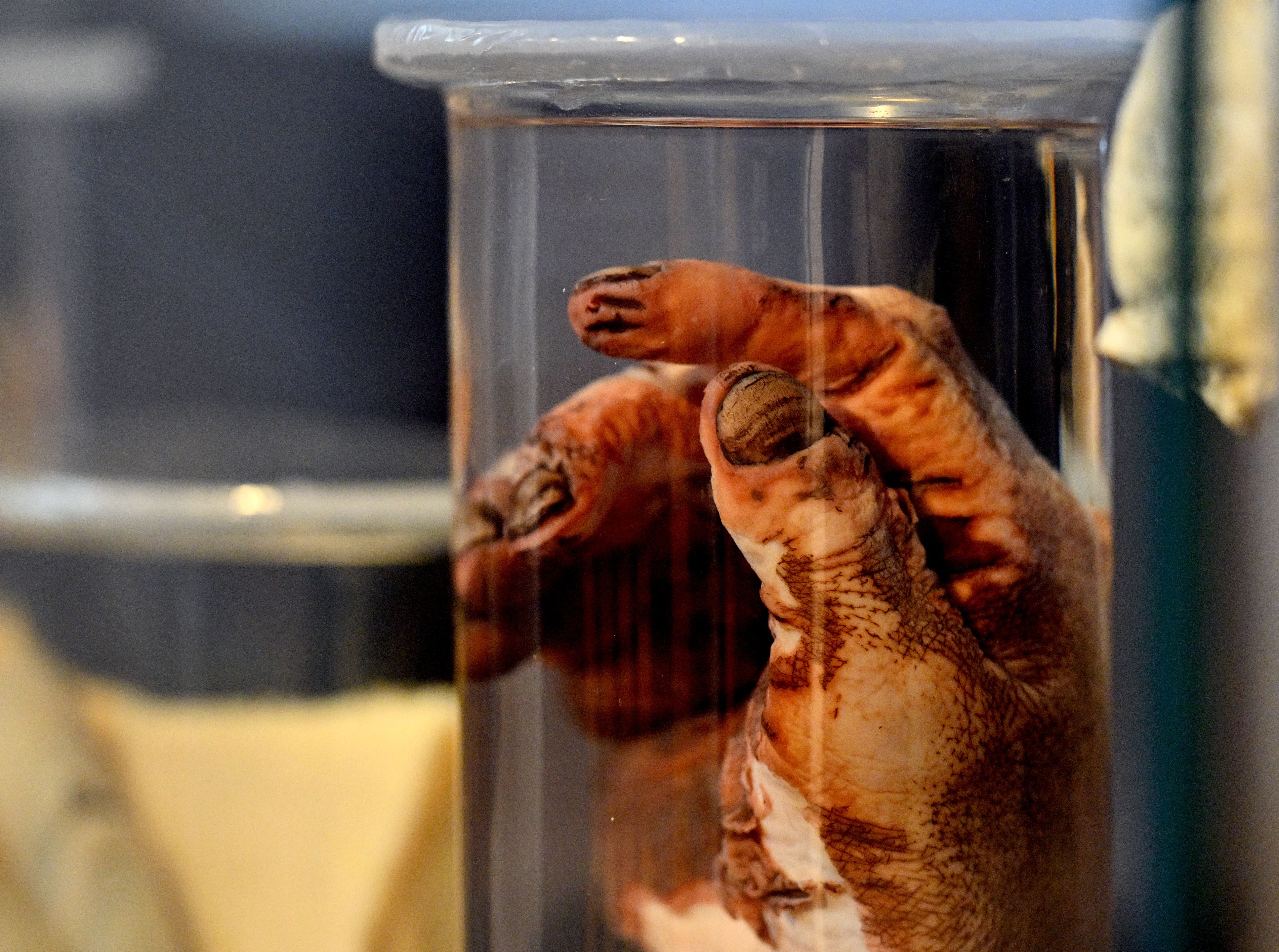 Präparierte menschliche Hand mit Stromunfall-Schäden in Glasgefäß, Ausstellung Narrenturm Wien.