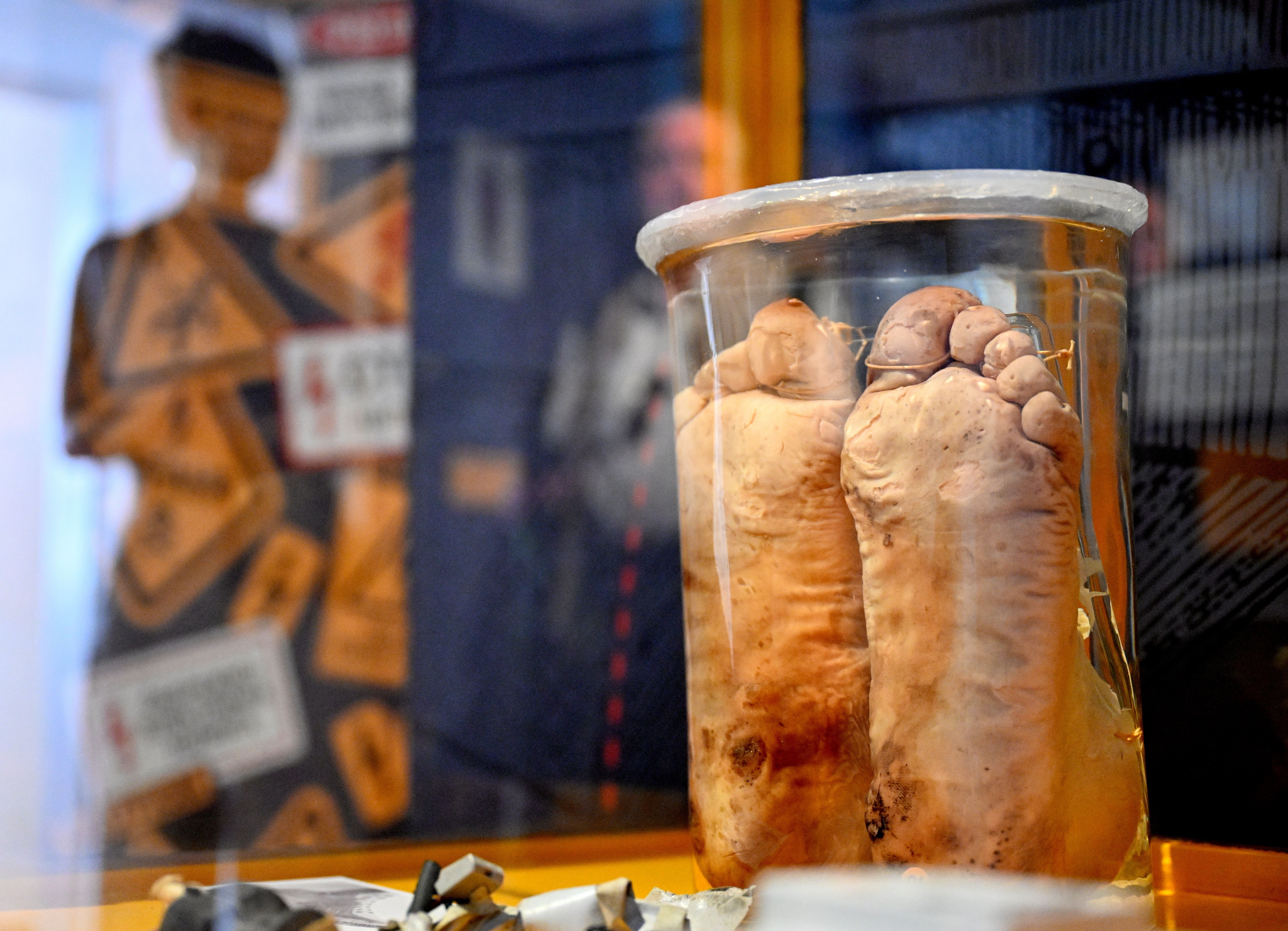 Präparierte menschliche Füße in einem Glasbehälter in einer pathologisch-anatomischen Ausstellung.
