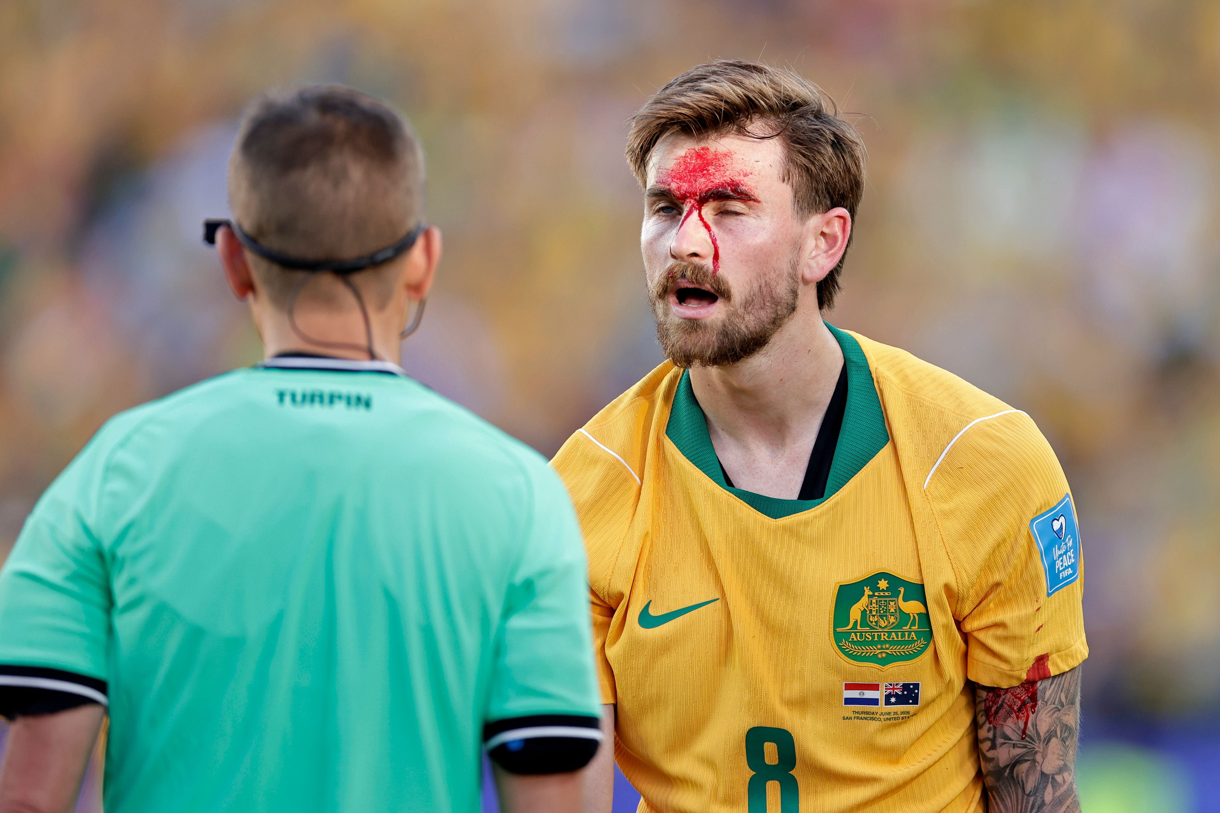 Ein australischer Fußballspieler im gelben Trikot spricht mit einem Schiedsrichter, blutend am Arm.