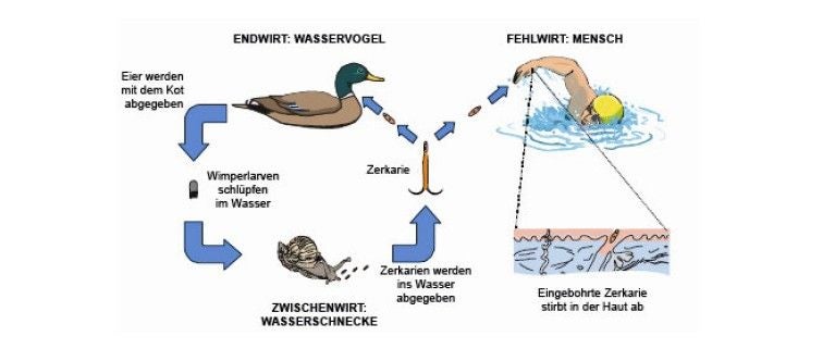 Kreislauf der Badedermatitis: Wasservogel, Wasserschnecke und Mensch als Fehlwirt.