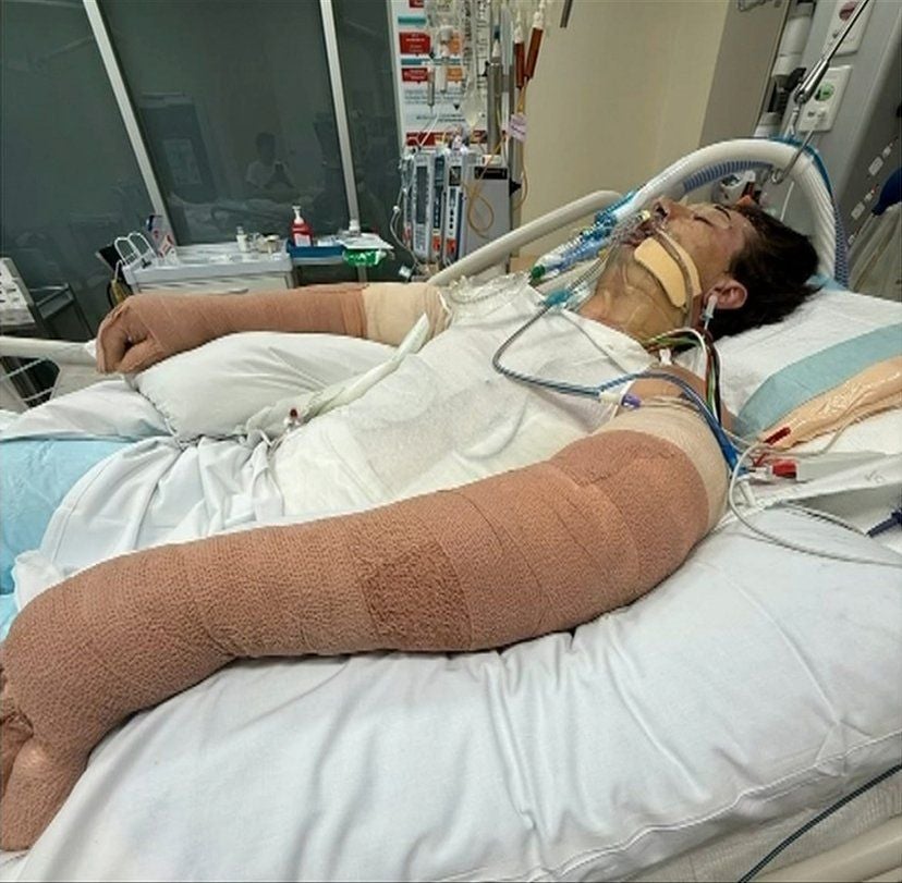 Ein Patient mit Kopfverband und verbundenen Armen liegt beatmet auf einem Krankenbett im Krankenhaus.