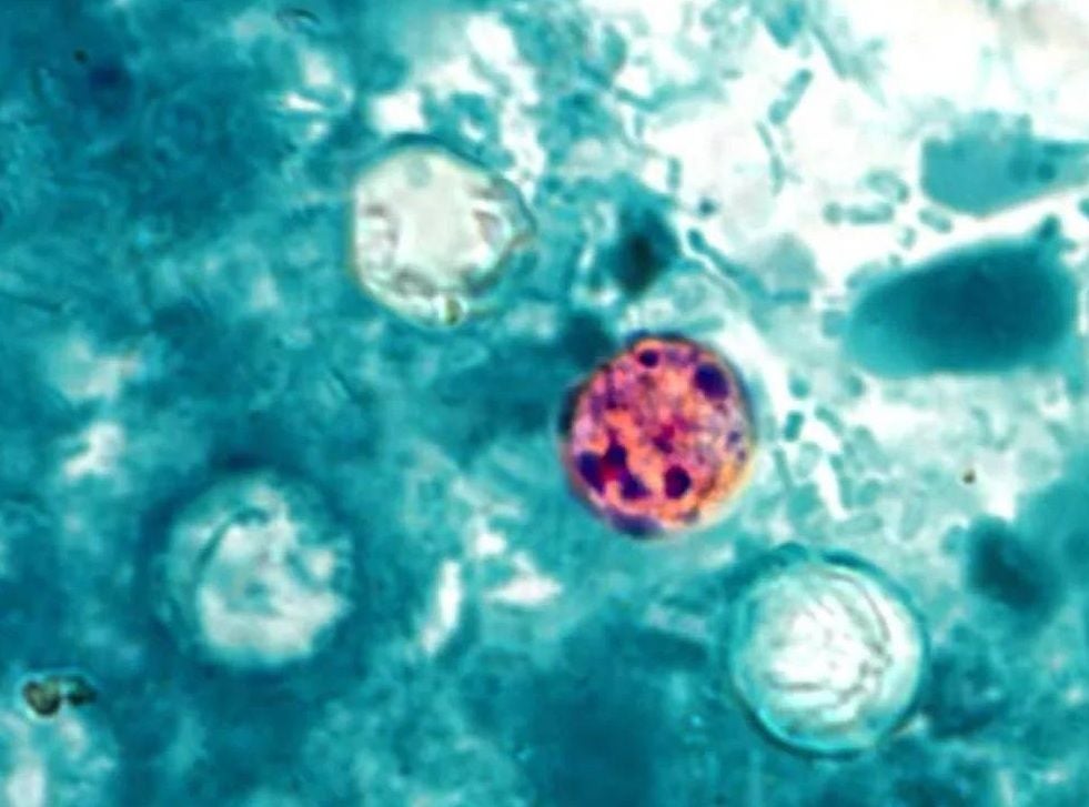 Mikroskopische Aufnahme von einzelligen Parasiten in blauer Flüssigkeit, ein Parasit ist rot gefärbt.