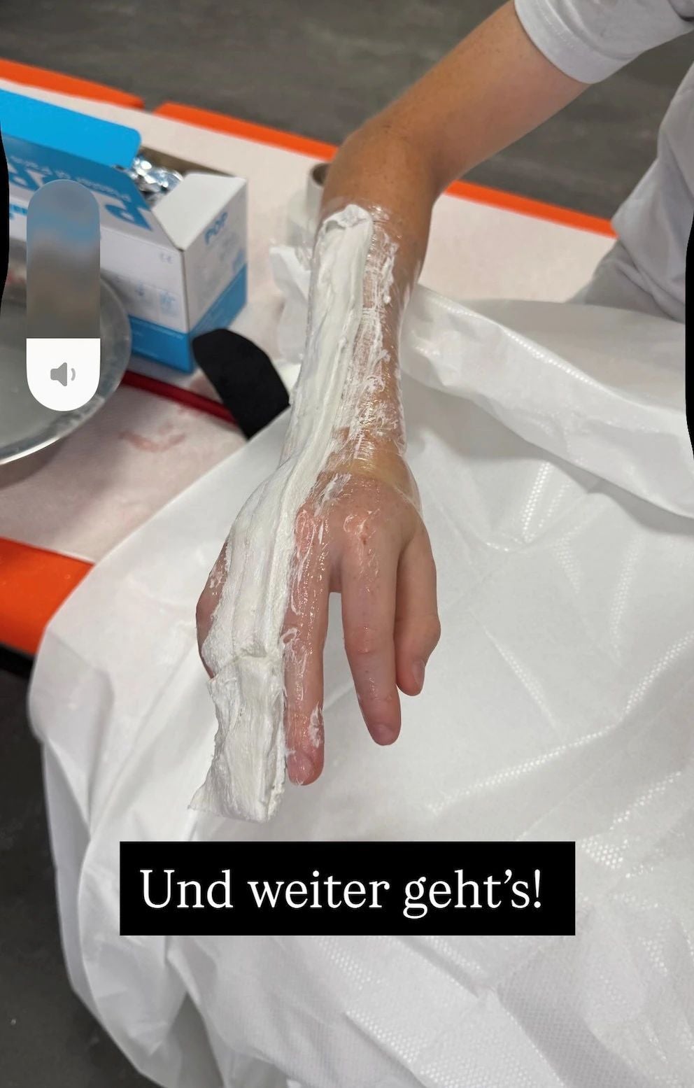 Gips für Oliver Pochers Sohn