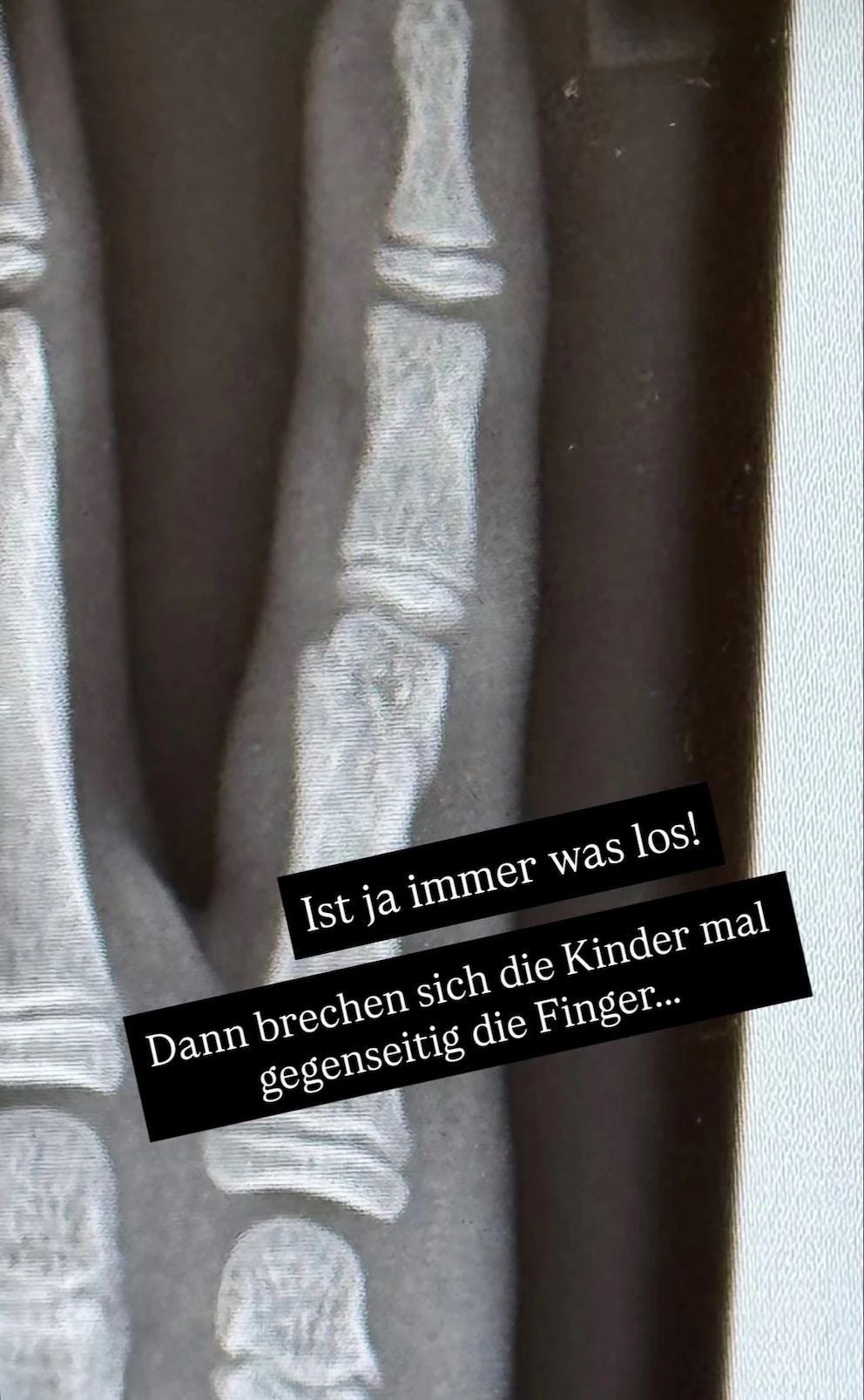 Röntgenbild von Pochers Sohn