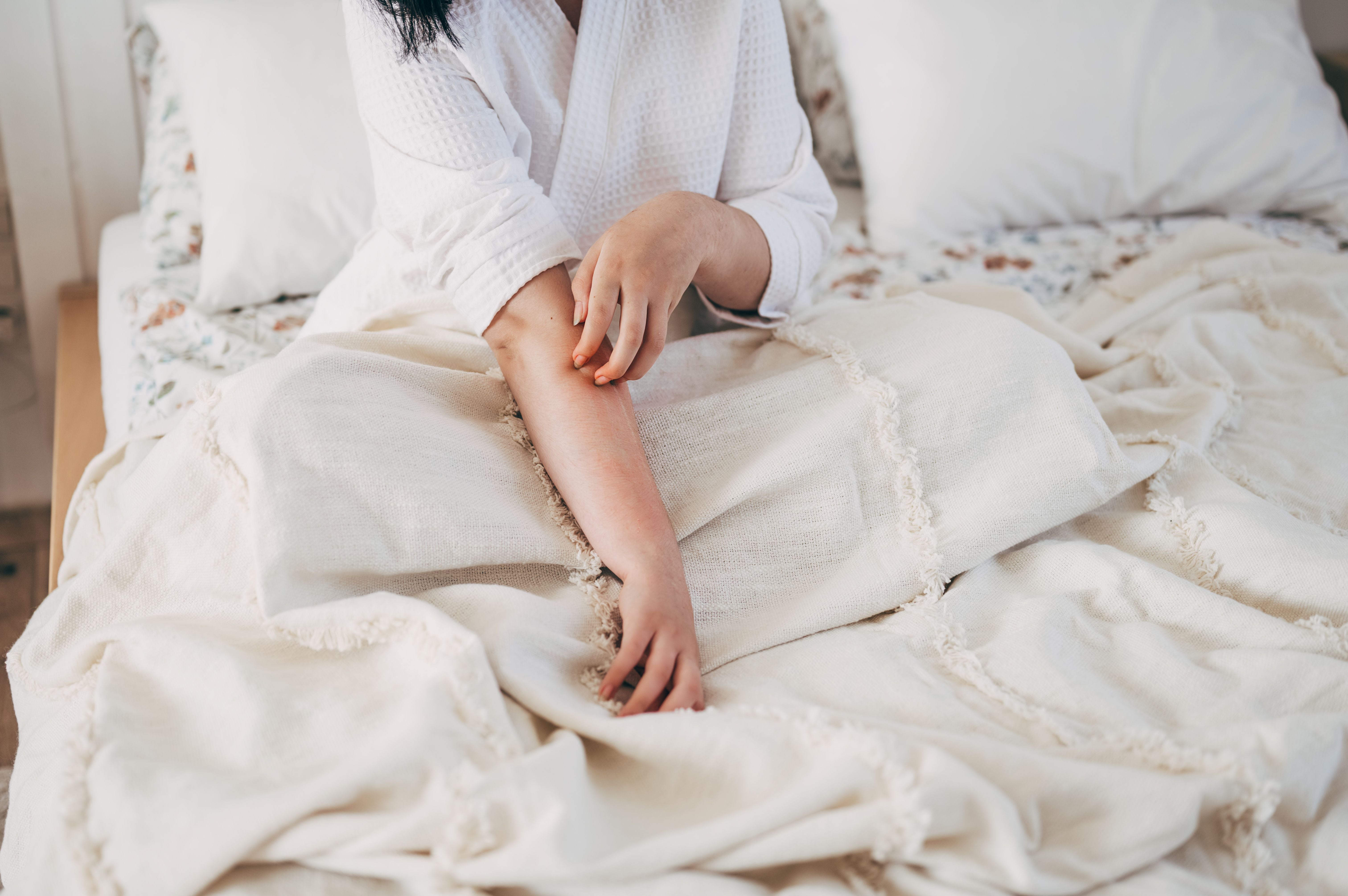 Frau kratzt sich am roten, gereizten Unterarm im Bett wegen allergischer Hautreaktion.