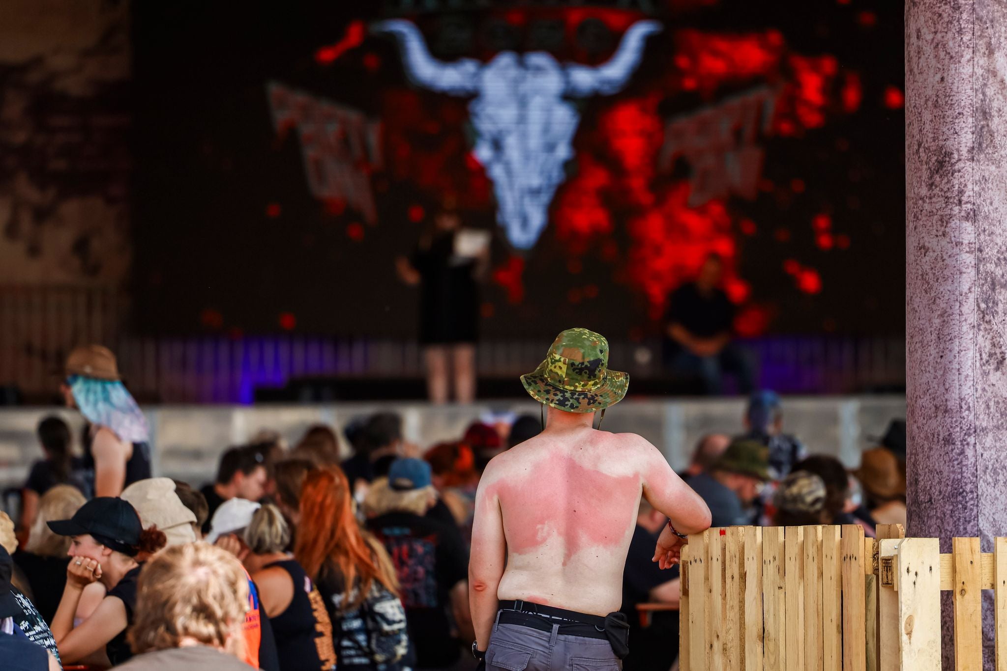 Ein Mann mit Sonnenbrand steht mit freiem Oberkörper vor einer Bühne beim Wacken Open Air Festival.